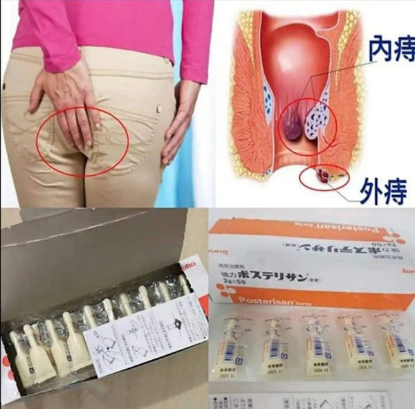 日本強力痔瘡膏 2g×5支