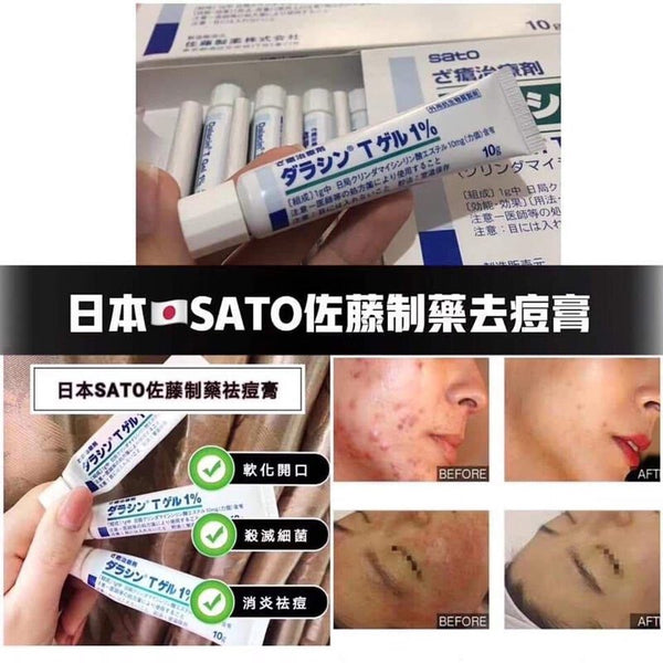 日本🇯🇵Sato 佐藤製藥祛痘膏10G