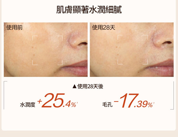 HBN α-熊果苷煥顏精萃水 150ml a-Arbutin Revitalizing Essence Lotion #發光水