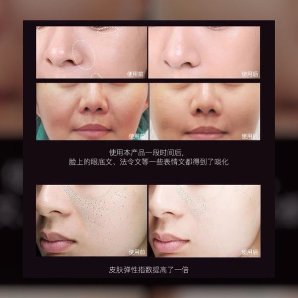 日本 DDS 限量版💜紫色緊緻胎盤小星星精華 48pcs