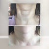 Shiseido 資生堂 Revital 莉薇悅薇 Neck Zone Essence 頸紋霜 75g