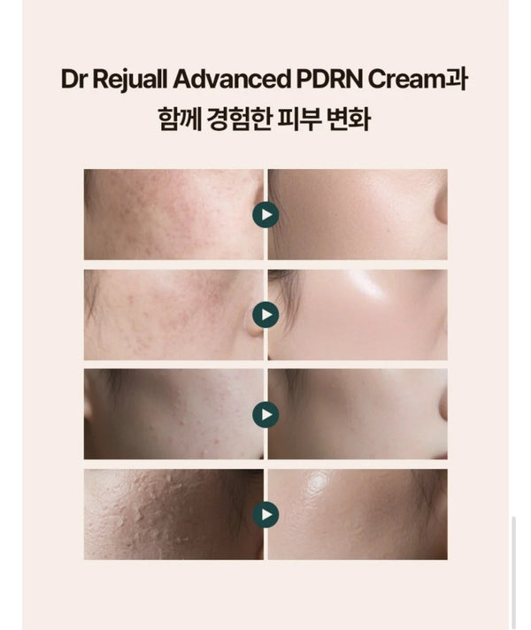 Rejuall Advanced Pdrn Relief Cream 20g 麗珠蘭PDRN 皮膚修復再生霜*韓國藥房及醫院*升級版