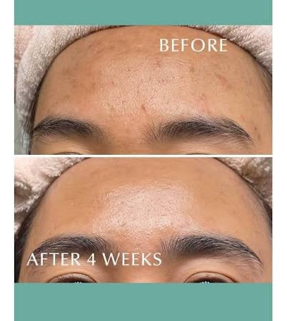 Albion💚奧爾濱健康水 55ml <sample> #健康化妝水 #抵御外界刺激呵護脆弱肌