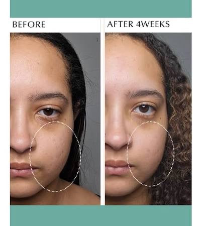 Albion💚奧爾濱健康水 55ml <sample> #健康化妝水 #抵御外界刺激呵護脆弱肌