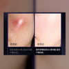uzupro•蘋果細胞修復精華液 30ml Apple stem cell essence 修護提亮原液玻尿酸 保濕抗衰老