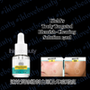 Kiehl's Truly Targeted Blemish-Clearing Solution 15ml Liquid Pimple Patch